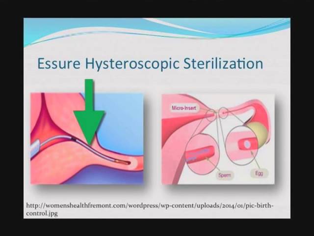 Minimally Invasive Options In Gynecology | Washington Hospital ...